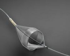 Abbott Vascular Emboshield NAV6 Embolic Protection System | Used in Carotid stenting  | Which Medical Device